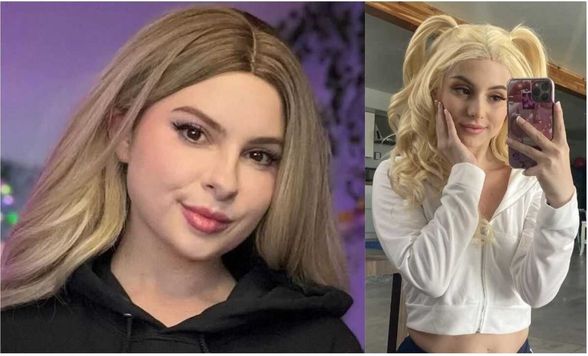 Brandy Renee Before Surgery