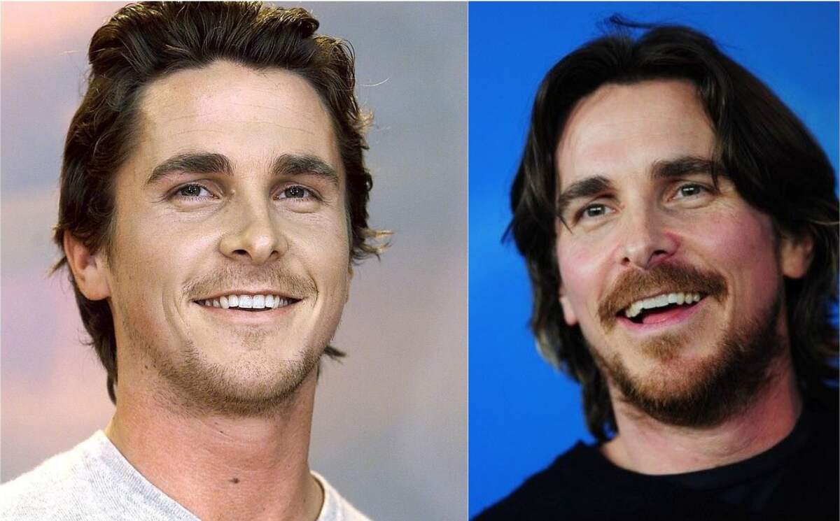 Christian Bale teeth